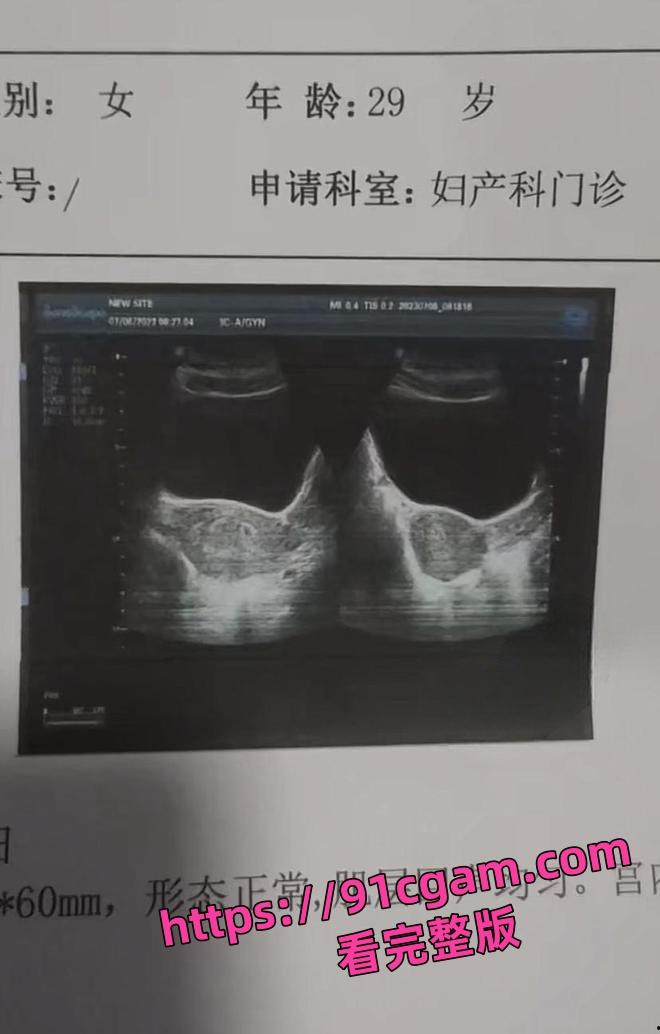 妻子实名举报!河南开封通许县孙营乡干部 毛云飞,买官出轨拿刀砍妻子-5