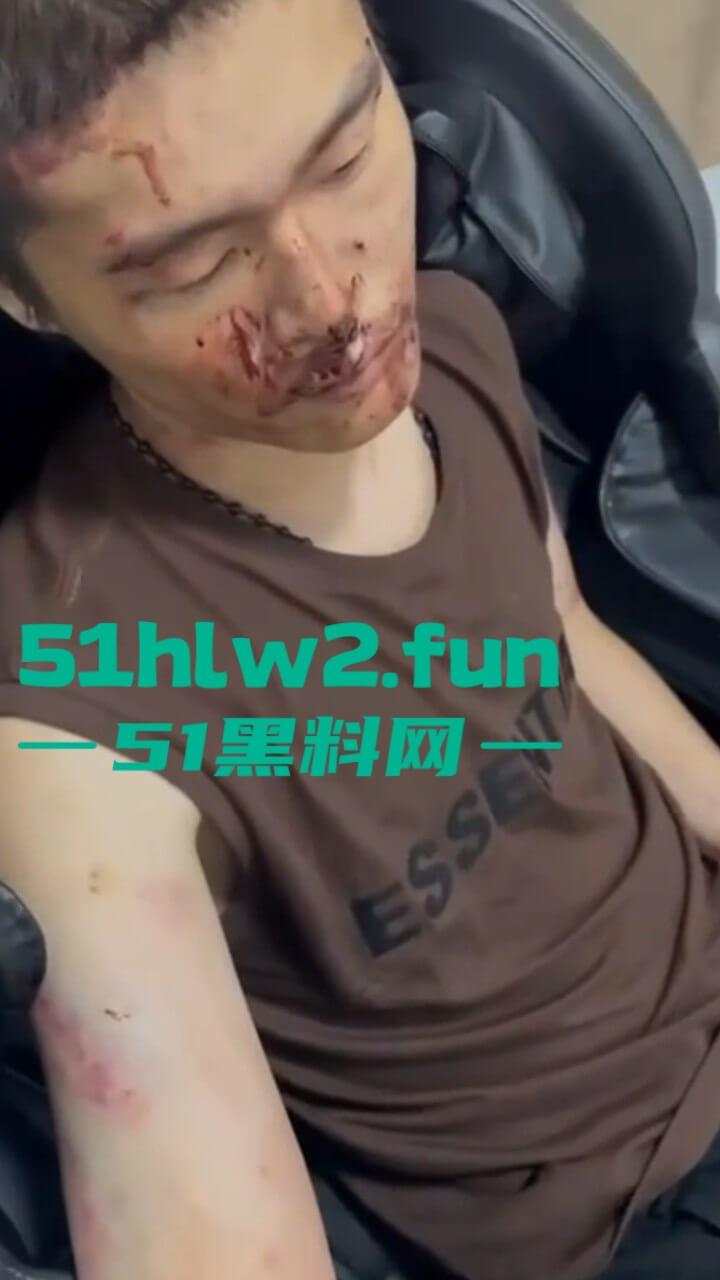 园区猪仔真实近况，绑架后只有受虐的份，电击殴打口吐鲜血境外没有高薪工作，只有无尽的折磨。-5