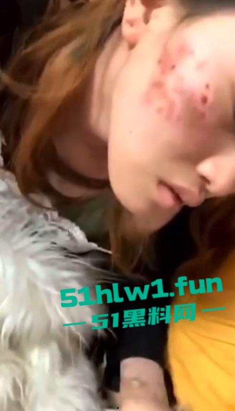 网传河南信阳病毒母体出入啤酒森林酒吧！毒王身体浑身溃烂吓退大量好友，当地交友群已炸开锅！-7